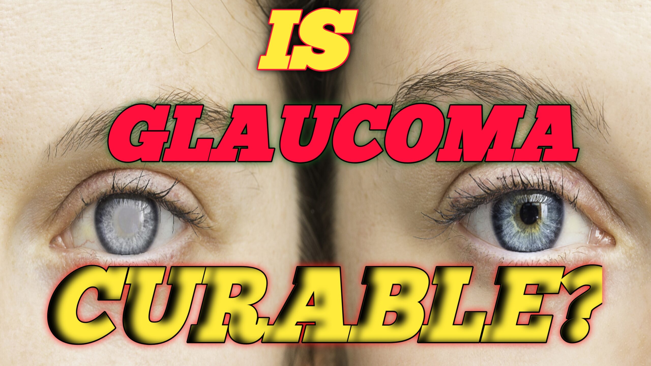 What is the treatment for glaucoma ?