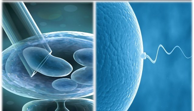 IVF : Secret information for the childless
