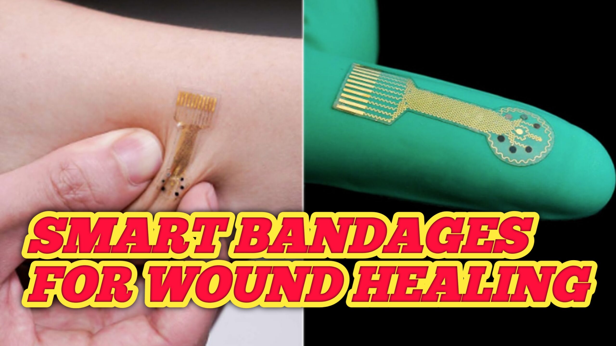 Smart bandages for wound healing